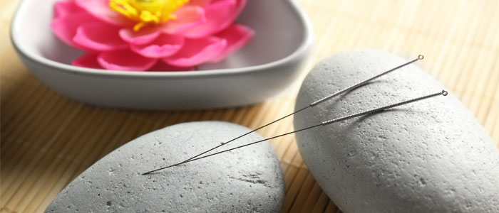 Acupuncture for Back Pain Merivale Chiropractic and Massage Clinic